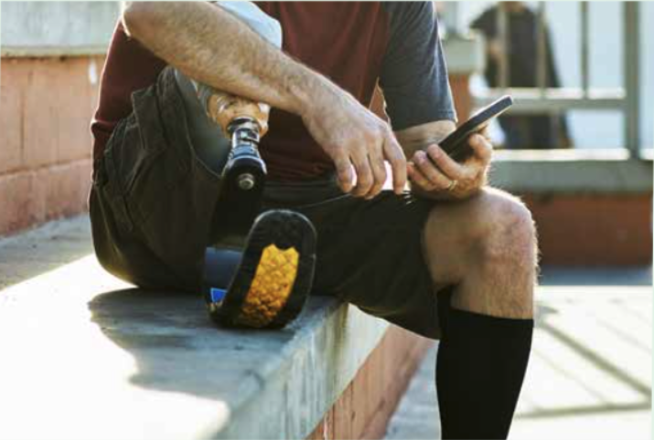 arion-slide-soluitions-prosthetics